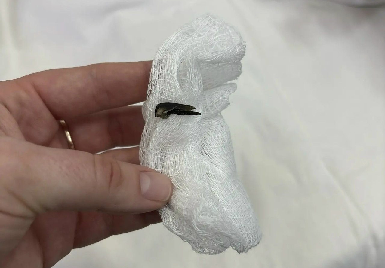 В Балакове годовалый малыш едва не задохнулся из-за застрявшей в бронхах семечки В Балакове годовалый малыш едва не задохнулся из-за застрявшей в бронхах семечки